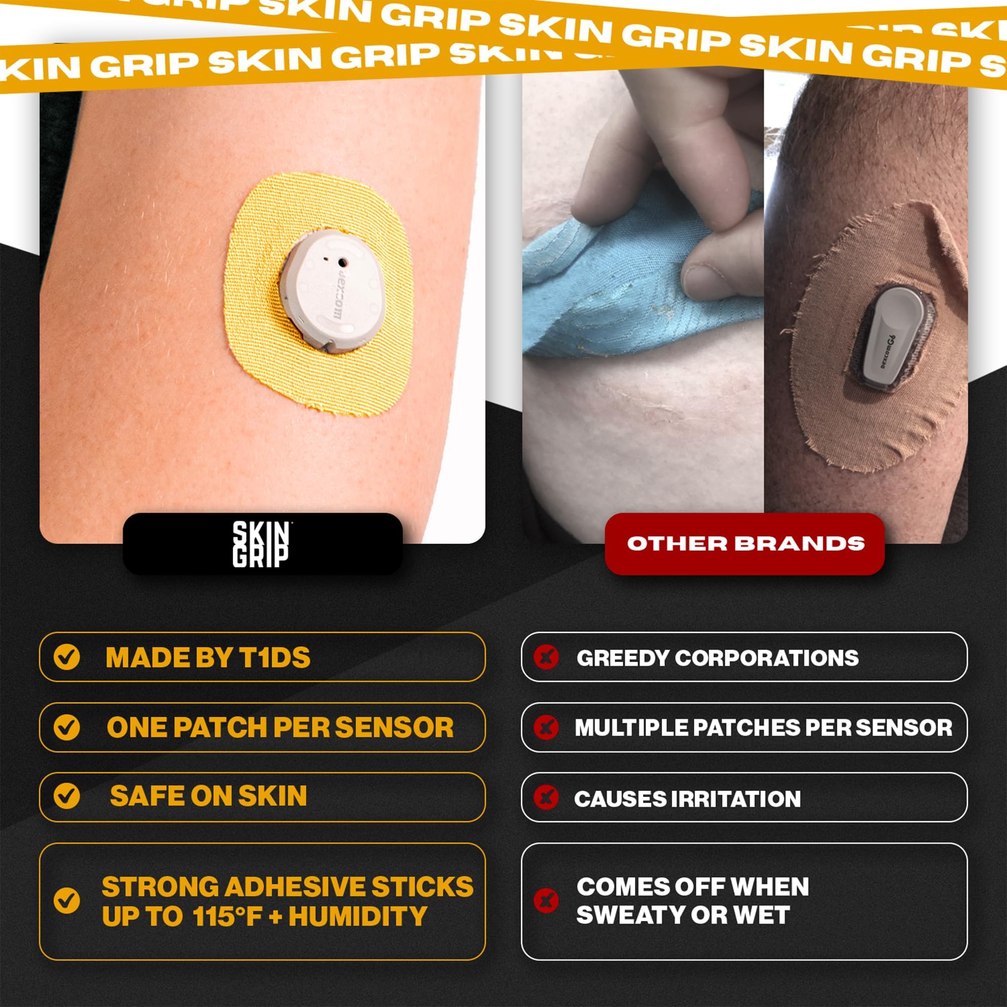 Breathable medical-grade adhesive reduces irritation while wearing Skin Grip patches