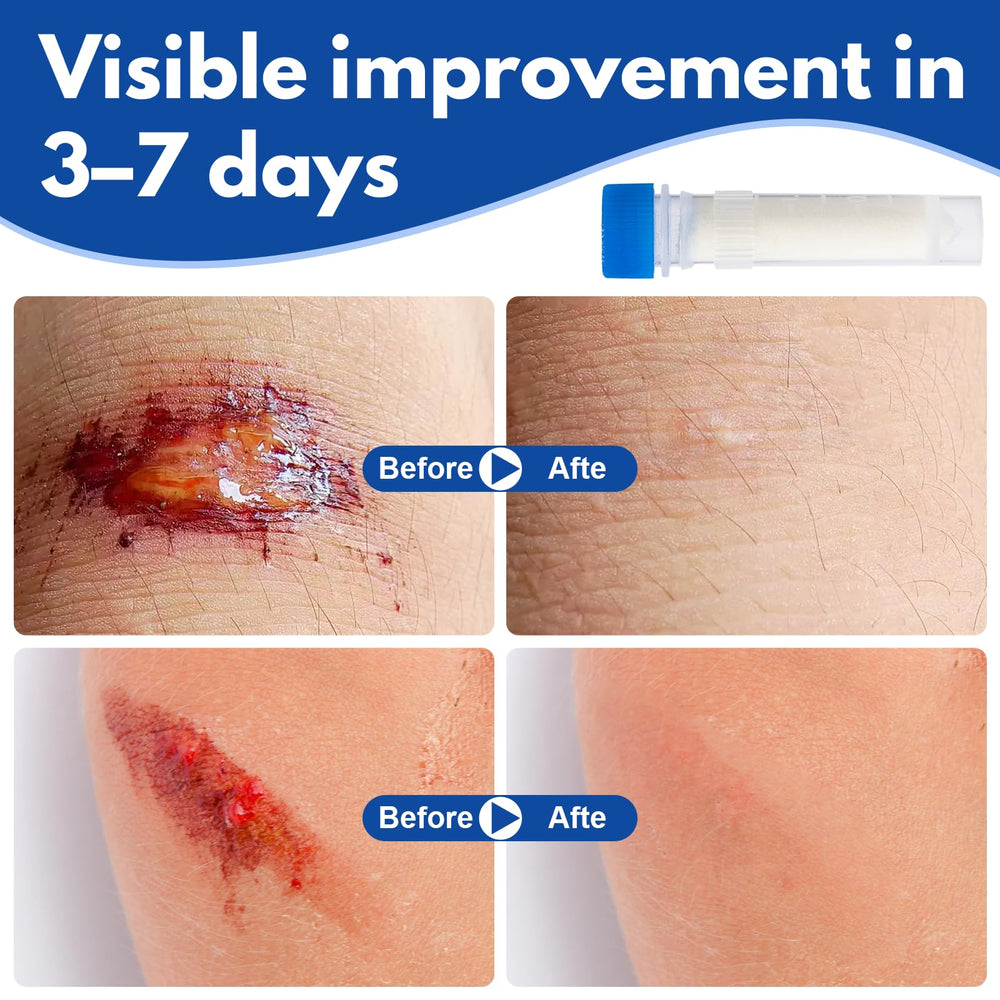 Smelling salts collagen powder texture close-up highlighting fine, adaptable granules for irregular wounds.