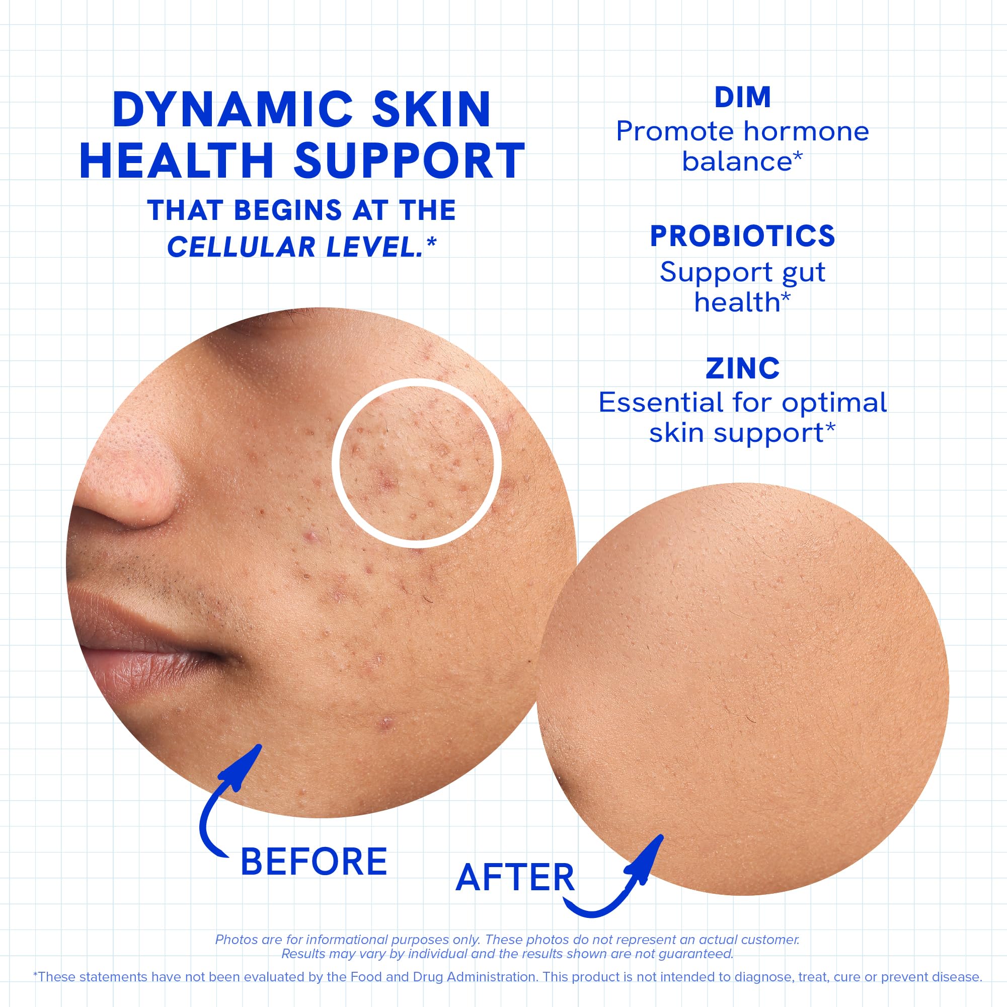 SMNutrition zinc and hyaluronic acid ingredients on the label.