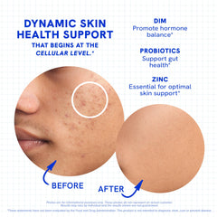 SMNutrition zinc and hyaluronic acid ingredients on the label.