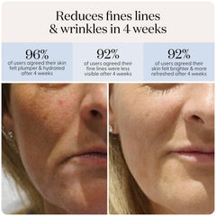 Smootskin DuoLux layered over hydrogel sheet mask for extra hydration.