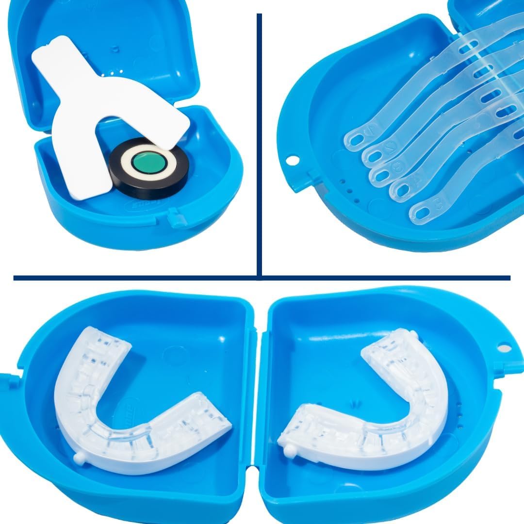 Somnofit-S close-up mold demonstrates personalized comfort.