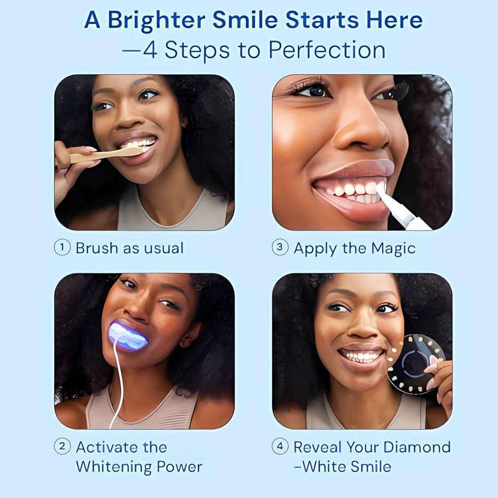 SNOW shade guide tracks whitening progress during home routine
