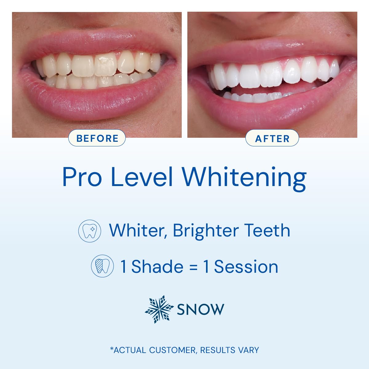 SNOW wireless teeth whitening kit shown for cord-free sessions.