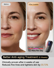 Sobetuar 4D red light mask close-up around eyes and cheeks for targeted treatment.