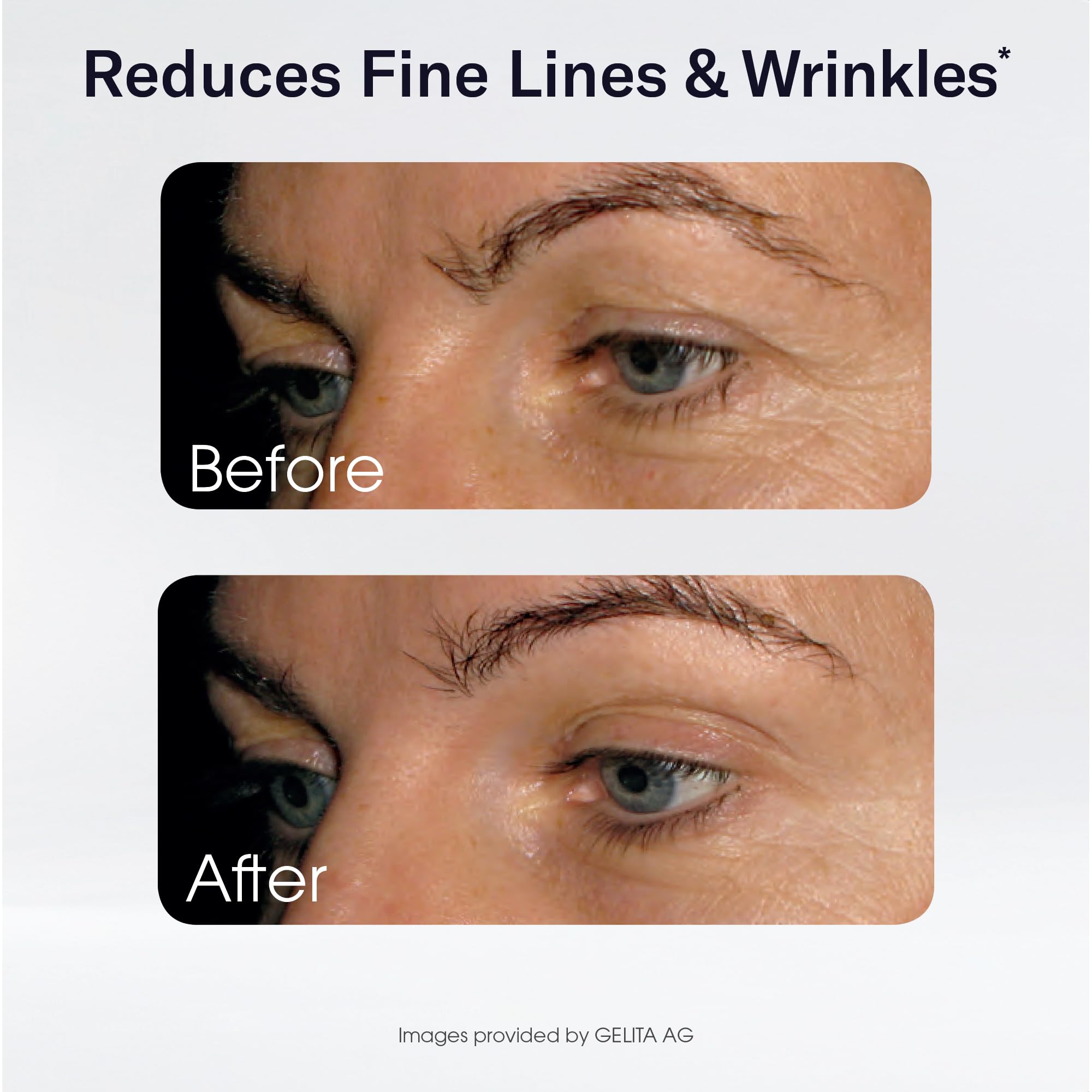 Close-up of Sparkle Wellness Skin Boost capsules showing smooth texture.
