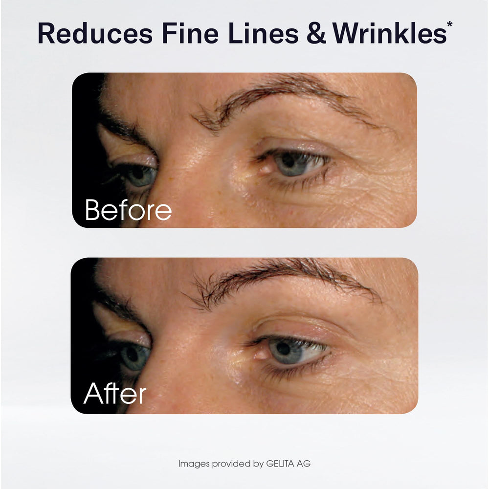 Close-up of Sparkle Wellness Skin Boost capsules showing smooth texture.