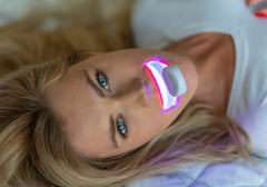 SPARX kit contents showing components for whitening routine