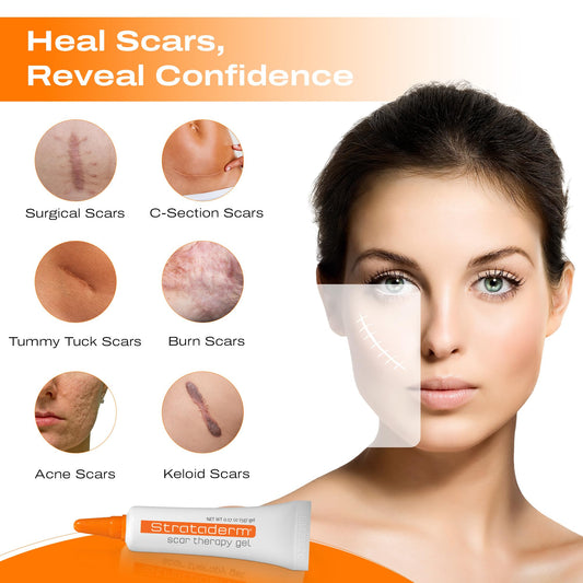 Strataderm gel on old and new scar shows versatile scar management.