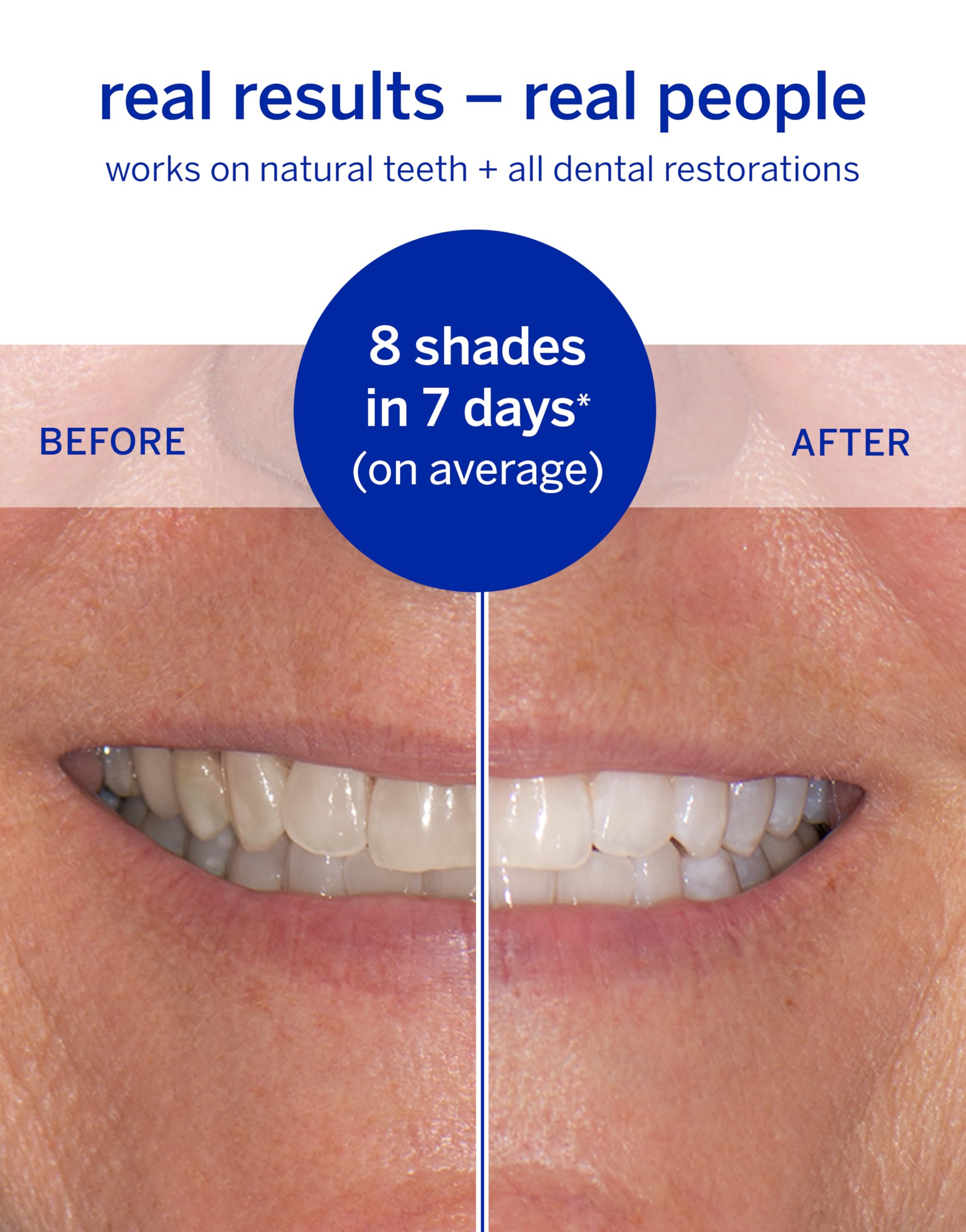 Supersmile dissolving strips 14-pack for easy at-home whitening.