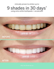 Supersmile Extra White gel closeup shows smooth texture for gentle whitening.