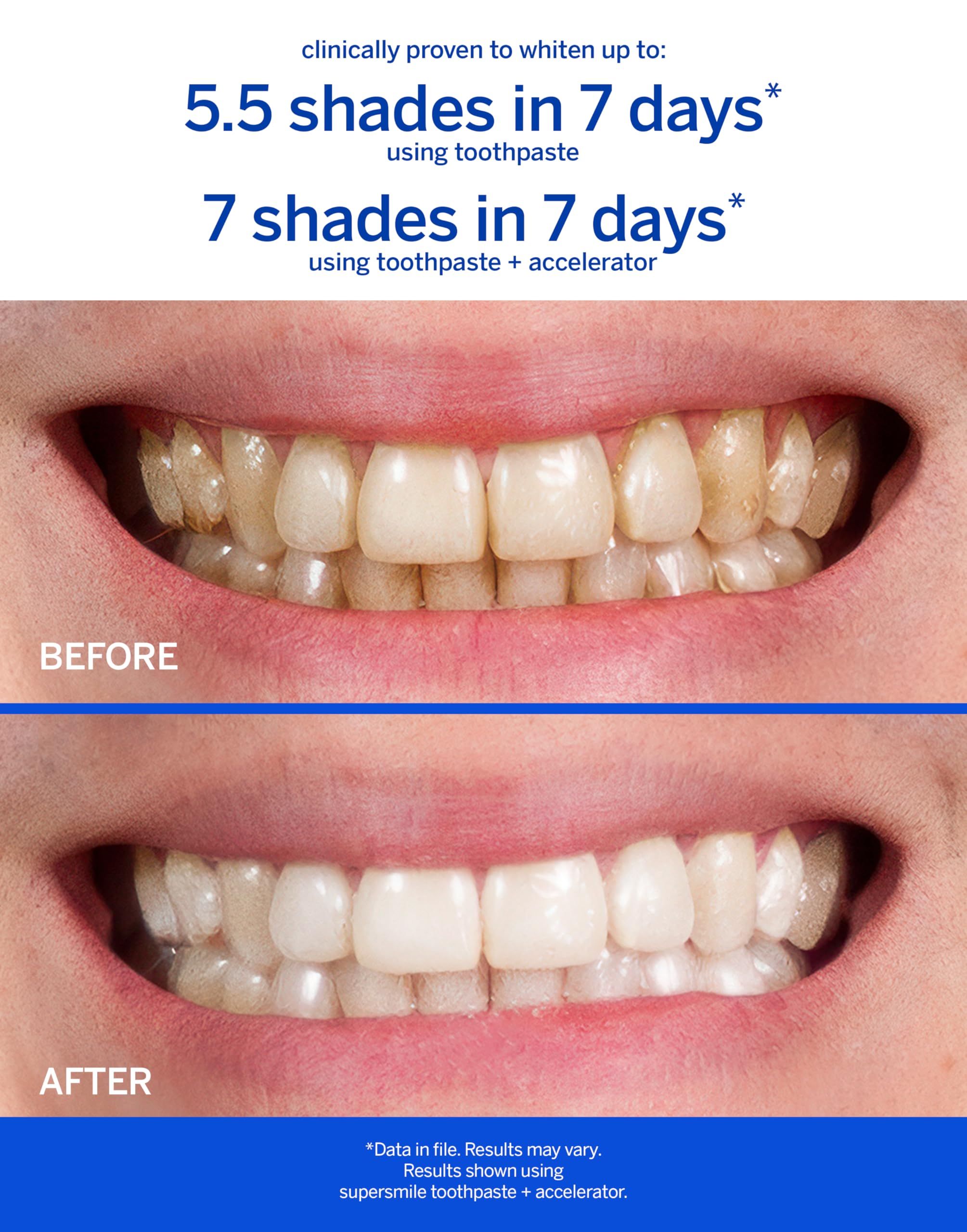 Supersmile Original Mint tubes trio packaging showcases complete whitening kit.
