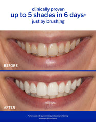 Supersmile Professional Whitening Accelerator application close-up targets stain removal