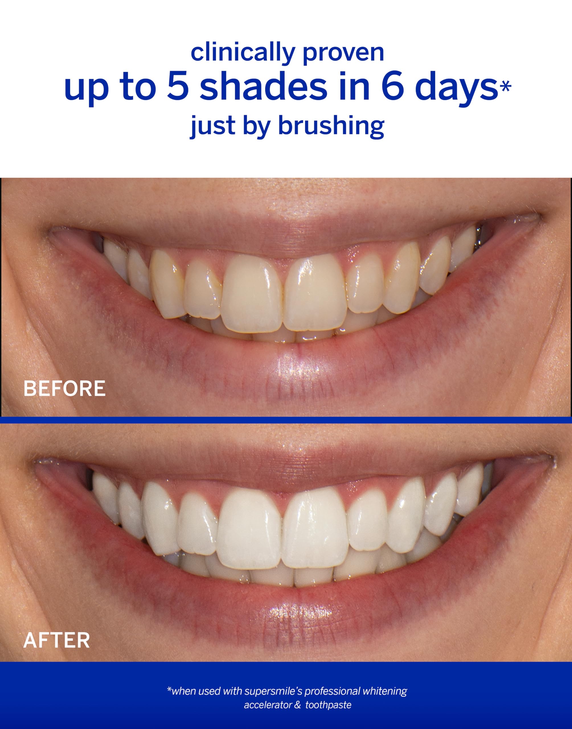 Supersmile Rosewater Mint whitening system accelerator highlights the whitening booster in action.