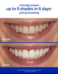 Supersmile Rosewater Mint whitening system accelerator highlights the whitening booster in action.