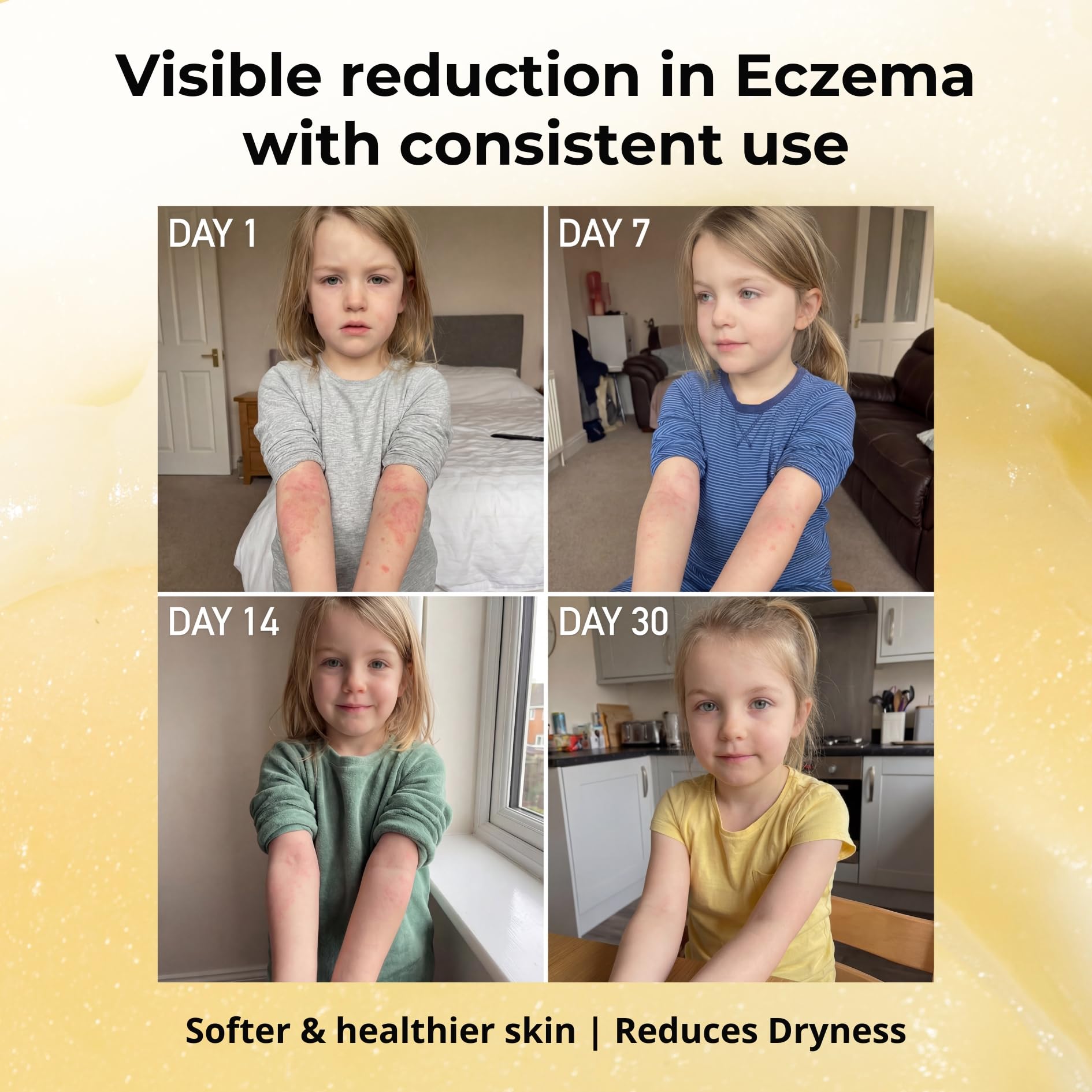 Sven's Island Miracle Manuka balm texture shows a rich, easy-to-spread ointment.