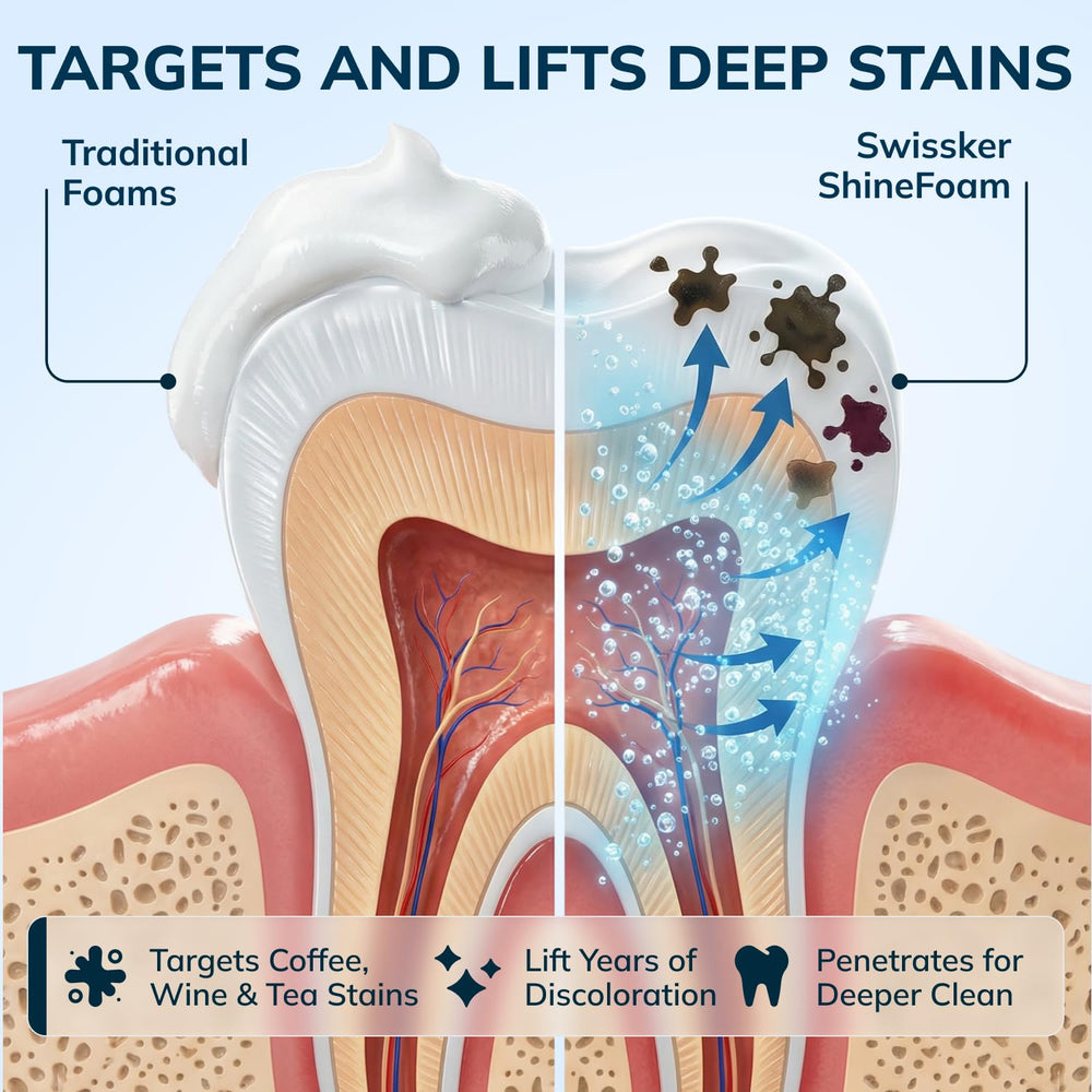 Aligners and retainers cleaning plus whitening in one daily foam routine.