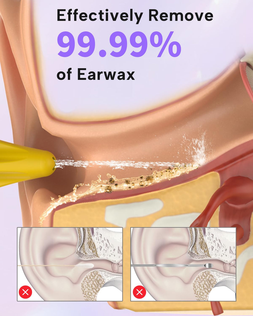 Sylvanthos ear wax kit with four modes supports gentle to strong cleaning.