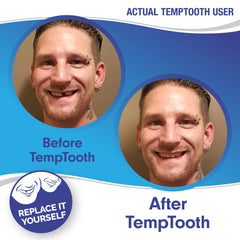 Temptooth safe oral-material highlights FDA-approved, non-toxic components.