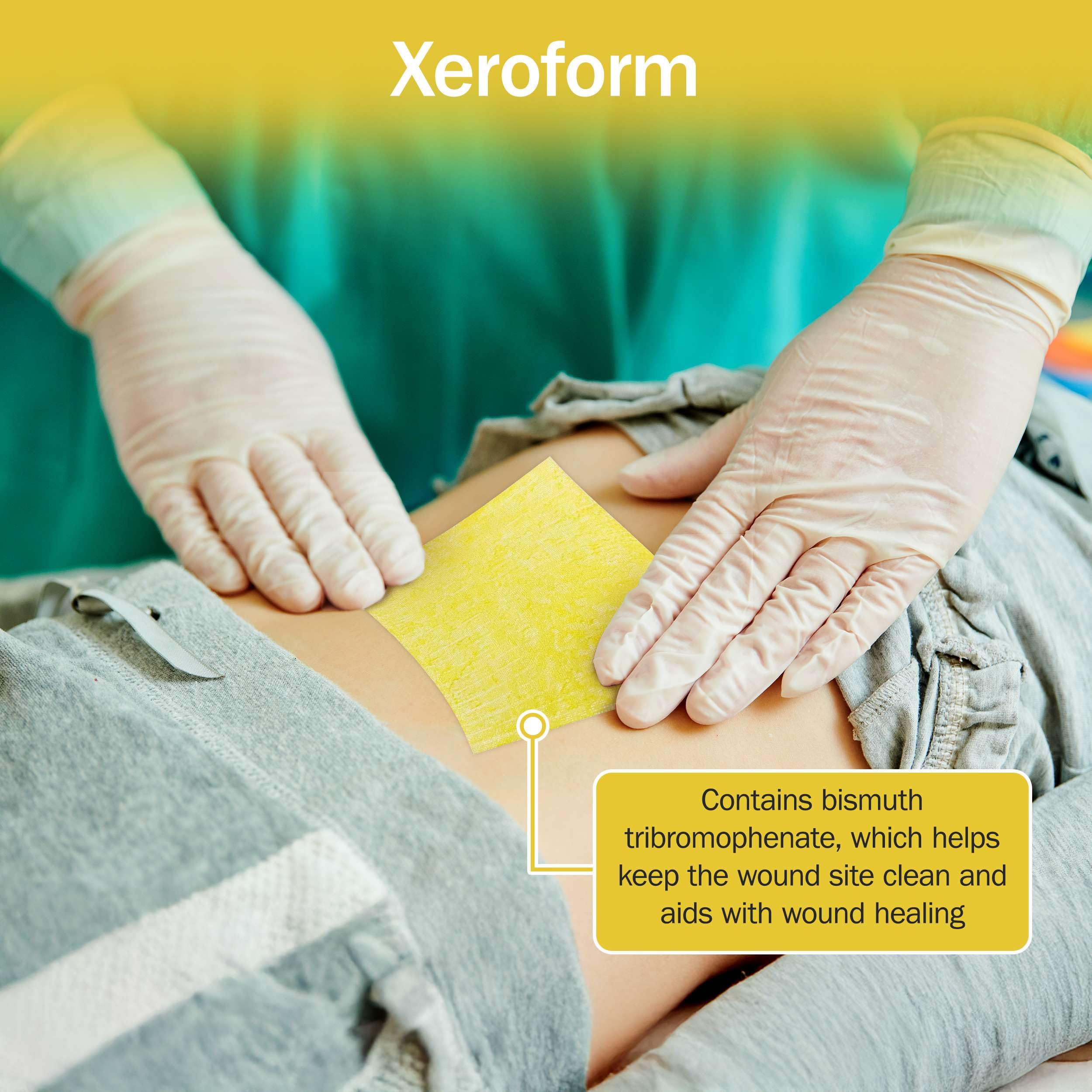 TenderGentle dressing contains bismuth tribromophenate to keep the wound clean