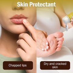 TenderGentle hands soften the skin with petroleum jelly after daily chores.