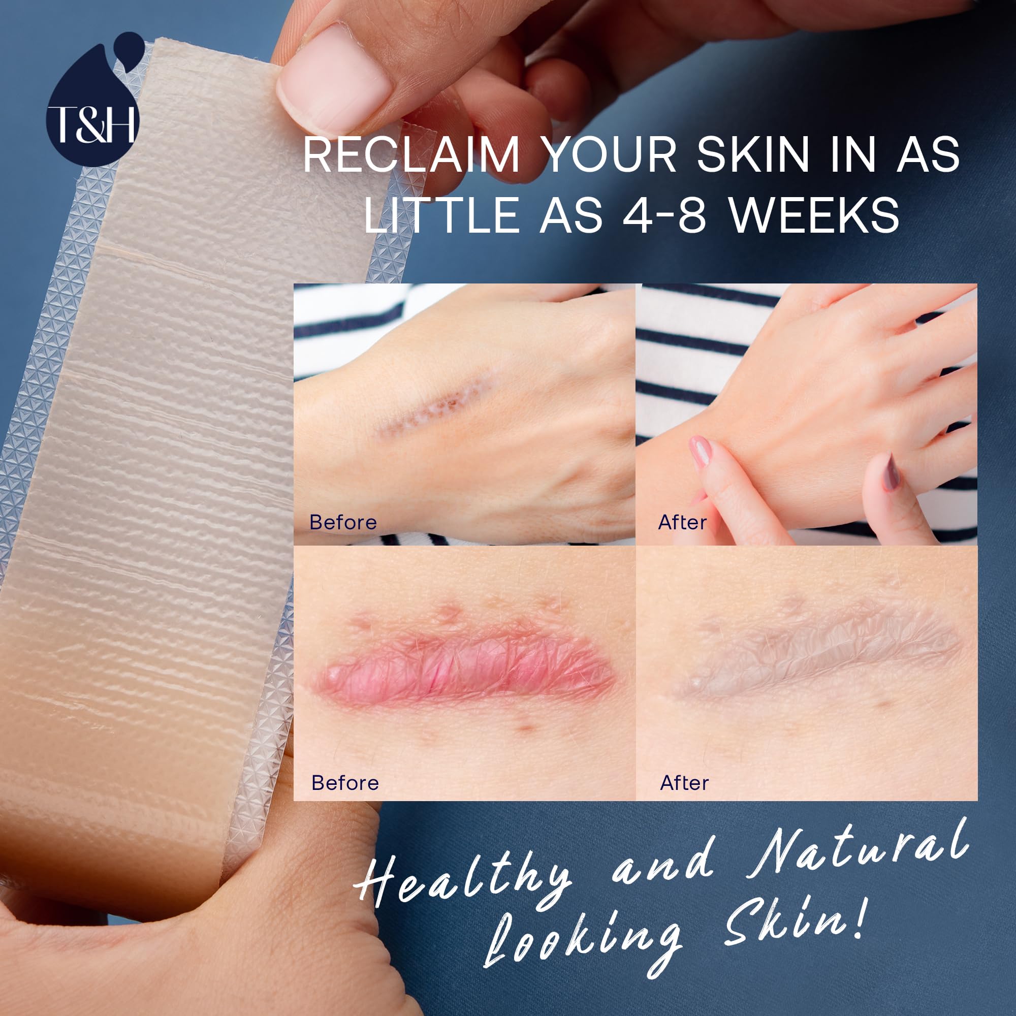 TEREZ & HONOR scar tape is colorless and odorless, suitable for sensitive skin.