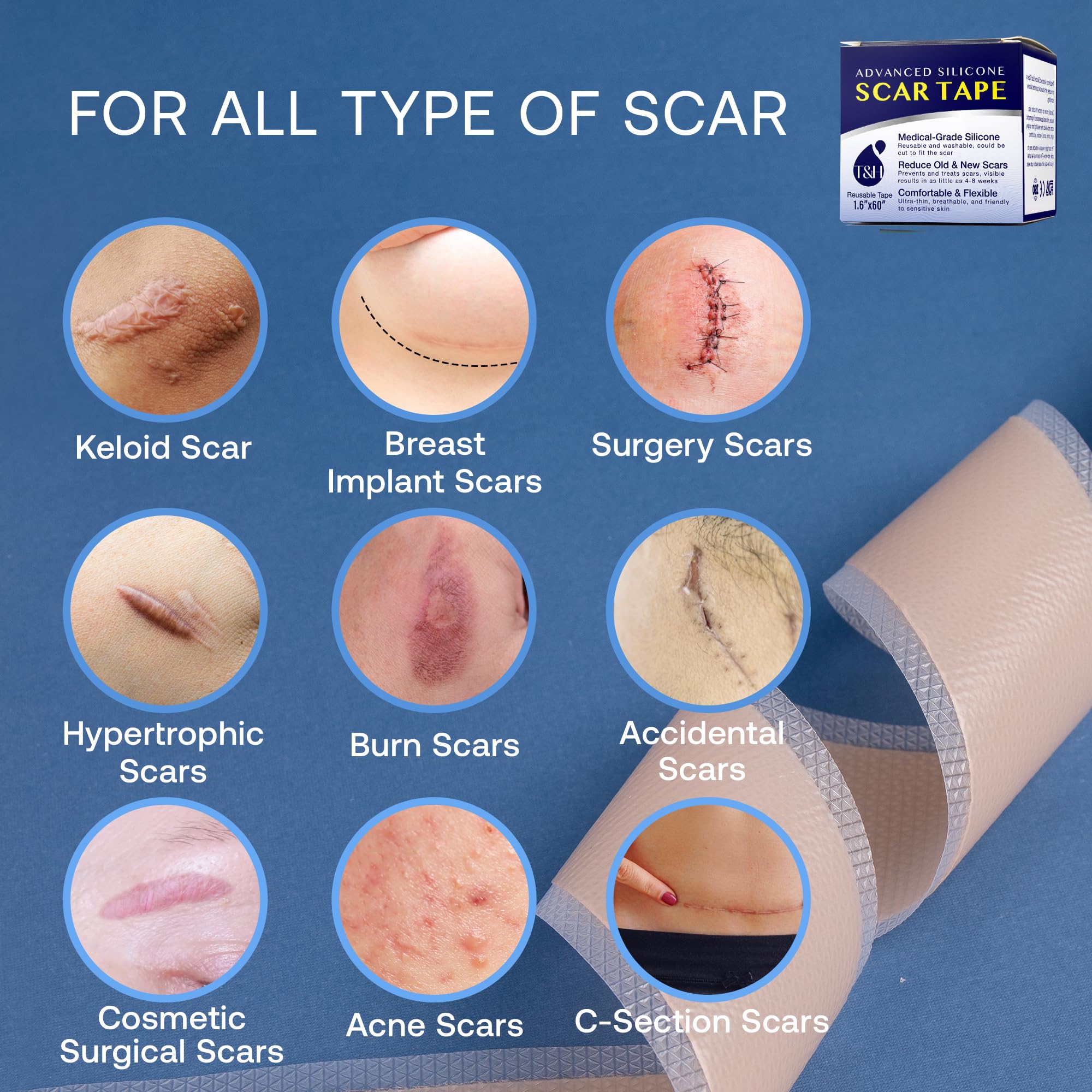 TEREZ & HONOR silicone scar tape is washable and durable for daily use.