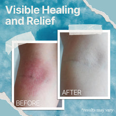 The Ocean Healed My Eczema cream on arm absorption