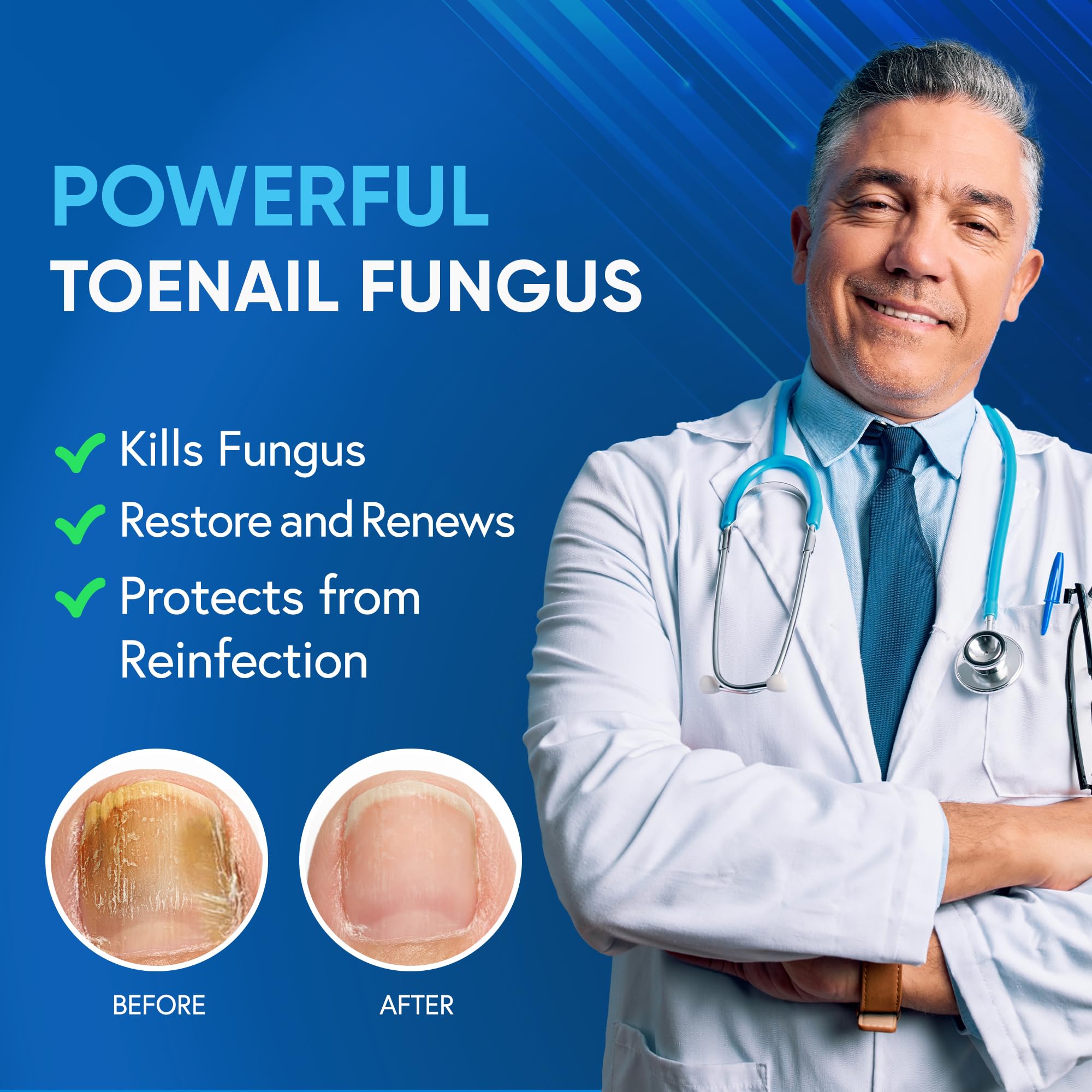 Tobcharm 25 percent undecylenic acid formula label supports targeted care
