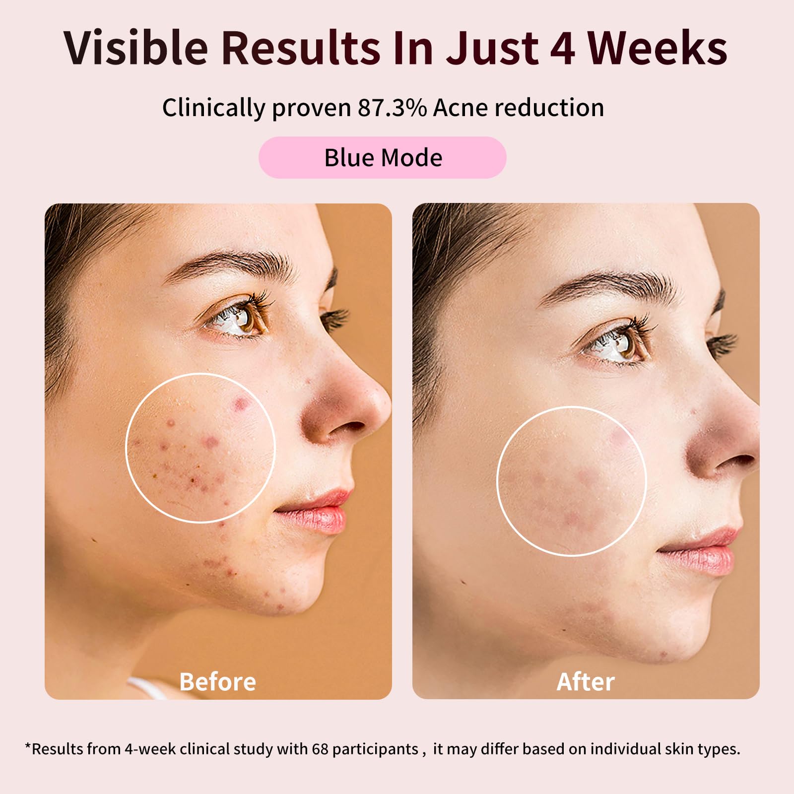 TOFEKIA flexible mask contouring to the face for even light coverage.