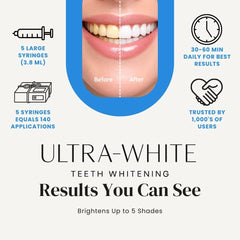 Ultra White dental tray whitening gel ready for use.