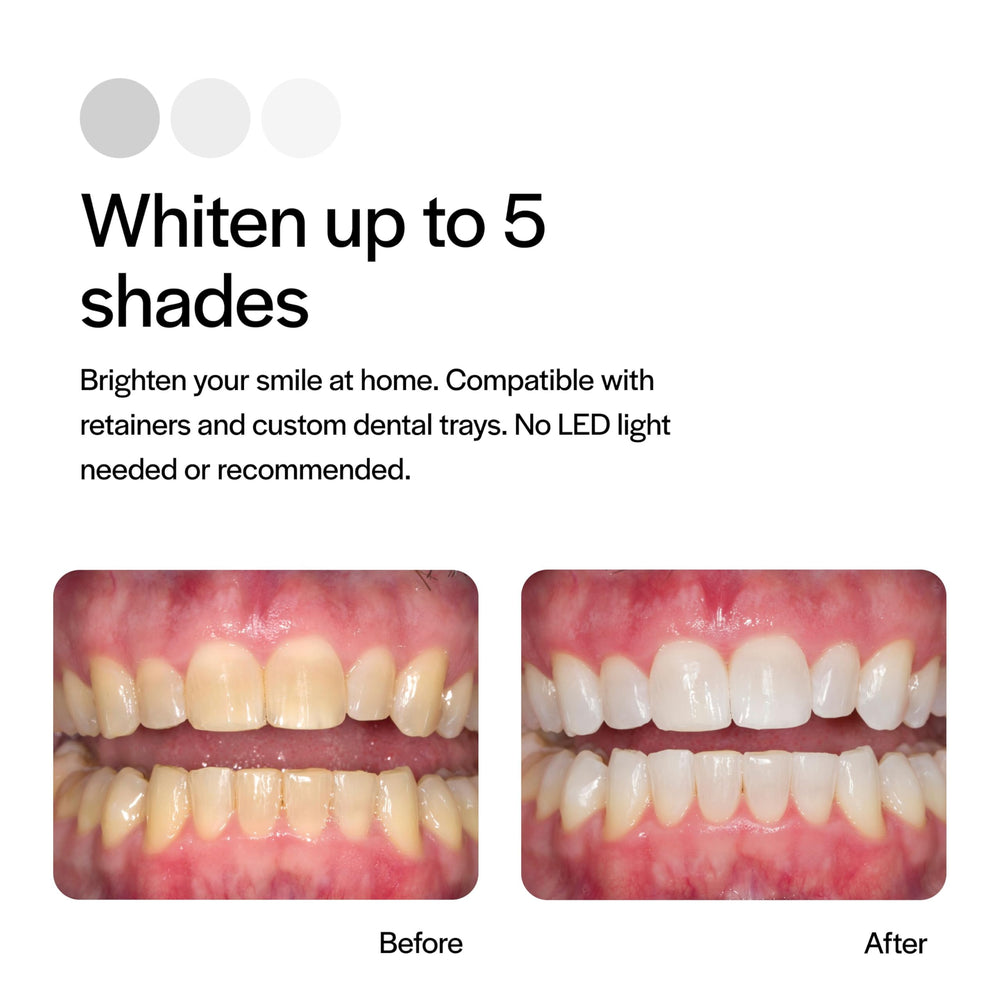 Ultradent Opalescence bamboo toothbrush included in the kit.