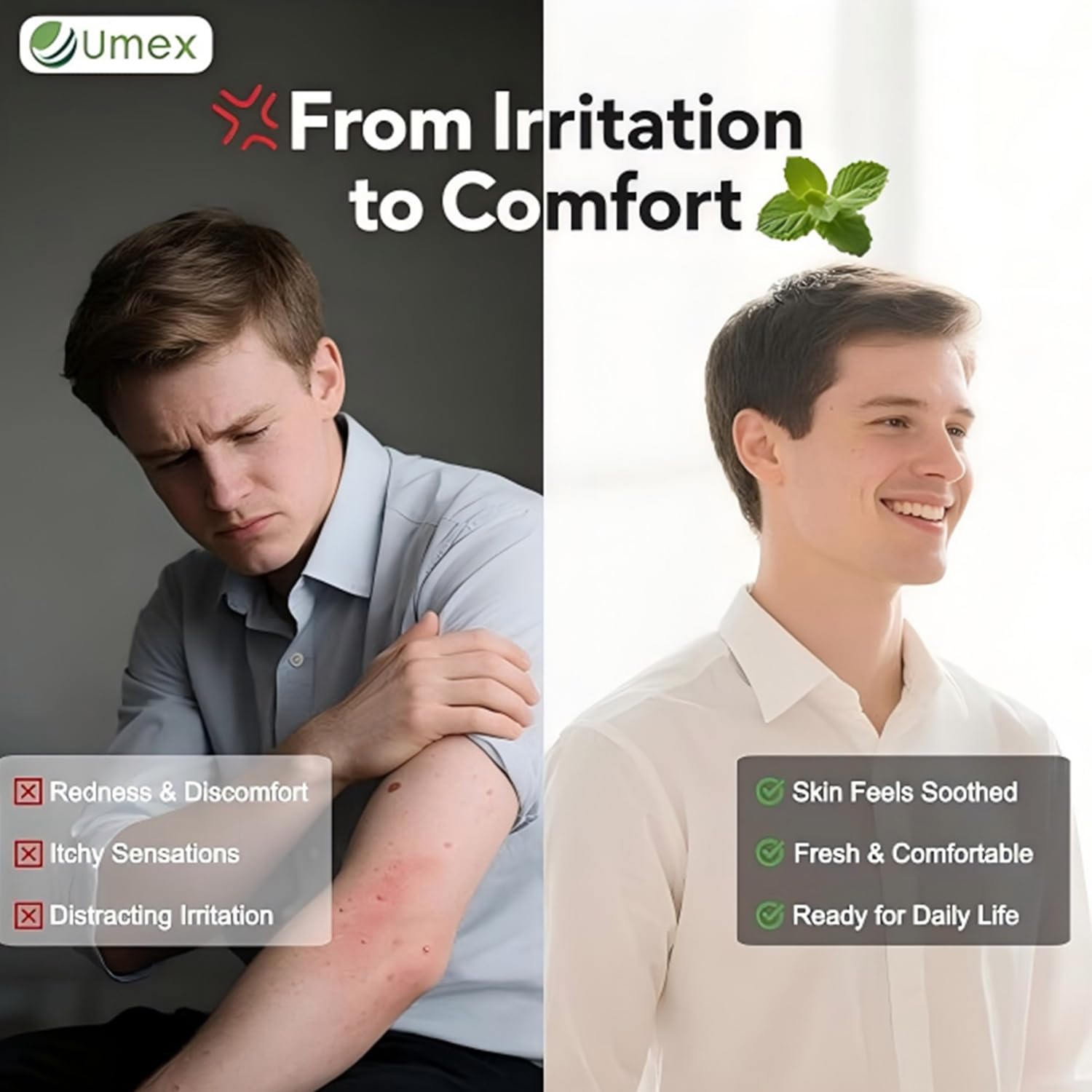 Umex Intensive Itch Relief Cream designed for daily use on dry patches.