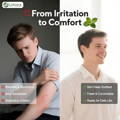 Umex Intensive Itch Relief Cream designed for daily use on dry patches.