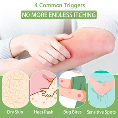 Umex Intensive Itch Relief Cream ingredients closeup featuring honeysuckle and aloe vera.