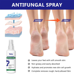 Vamy clinically published nail solution bottle for targeted nail care.