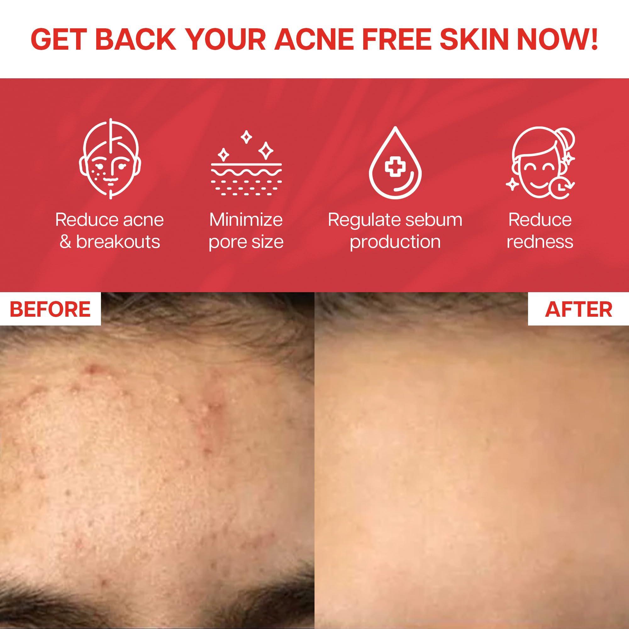 Ventamin Clear It zinc and probiotics for healthy skin tissue.