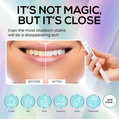 Venus Visage syringe with dosage line supports controlled, accurate whitening application.