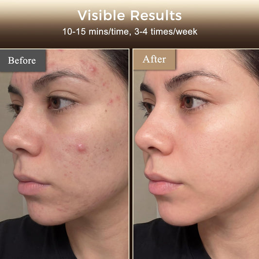 Verfubo neck attachment extends coverage for neck treatment
