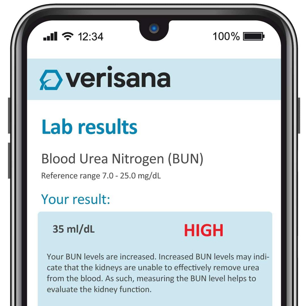 Verisana kidney test sample-collection shows simple at-home sampling