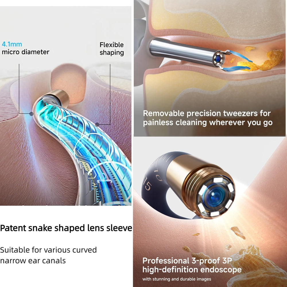 VILLA ART Earsight Plus E33R Wi-Fi connects to your phone securely.