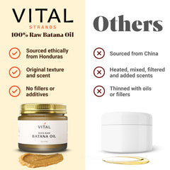 Vital Strands Batana: detox del cuero cabelludo y alivio de picor.