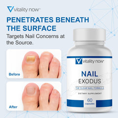 Vitality Now Nail Exodus pack shot with two bottles for extended use