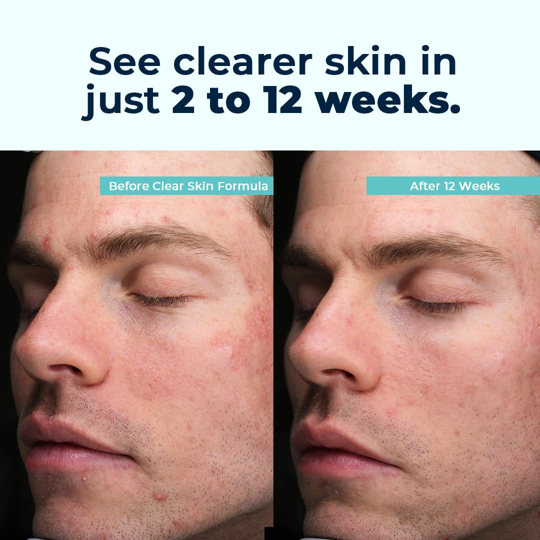 Glass VitaMedica Clear Skin Formula bottle on a clean countertop