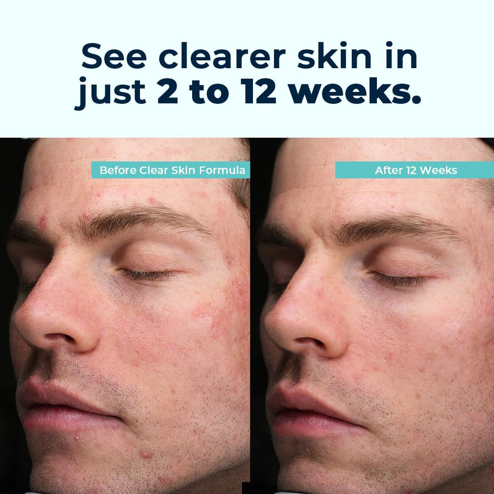 Glass VitaMedica Clear Skin Formula bottle on a clean countertop