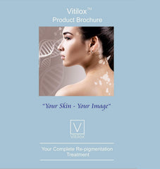 Vitilox T-Cell-V capsules on a clean surface for everyday use.