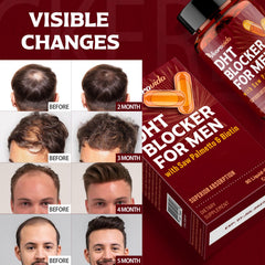 Nutrition label and packaging for Vivaravida DHT Blocker