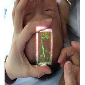Vivolight Vein Viewer Pro LCD display close-up with clear readout