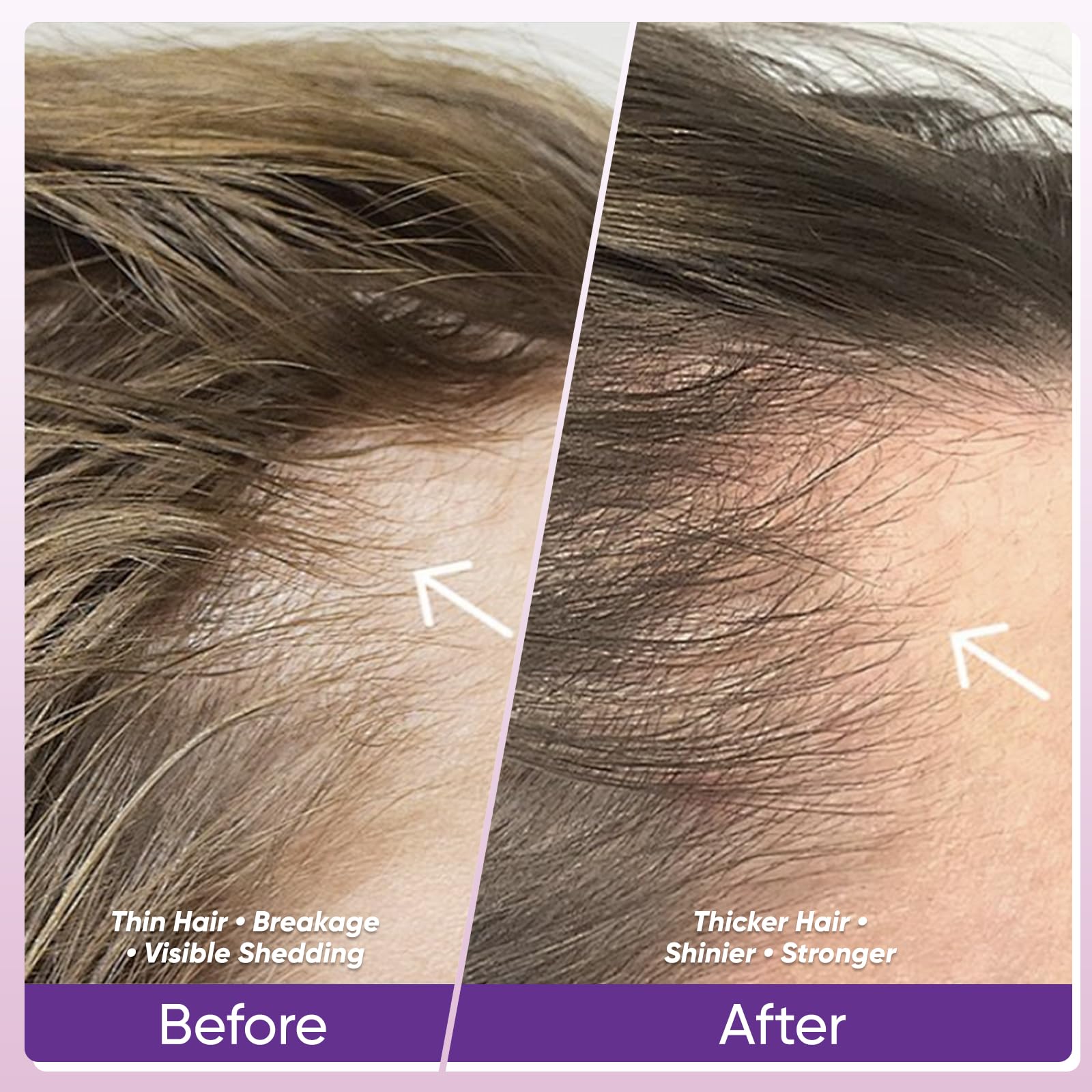 WGYPEU collagen blend softgel close-up highlighting skin and hair benefits.