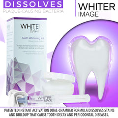 Whiter Image Deluxe Mouth Tray designed for a snug, slip-free fit during whitening.
